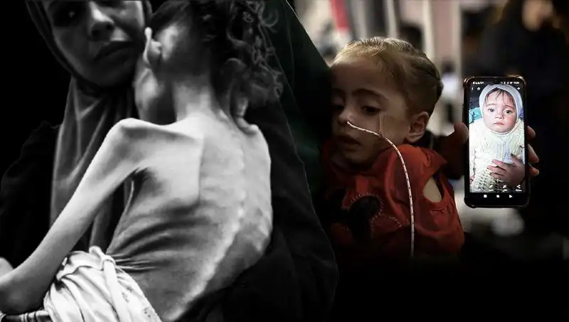 25 Kilodan 10 Kiloya Düşen Küçük Meryem: Açlıkla Mücadele Eden Bir Çocuk