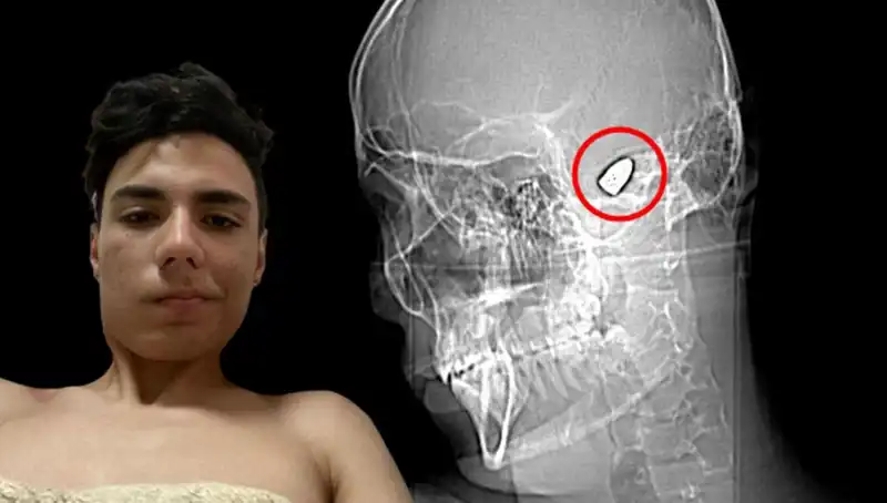 Patlama Noktasındaki Zihin: Kafasında Bomba Taşıyan İnsanlar ve Etkileri
